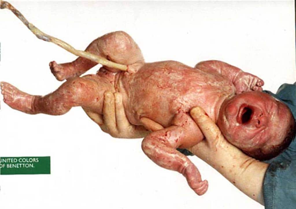 베네통 광고 Baby, we’ll get through this 1993년 광고